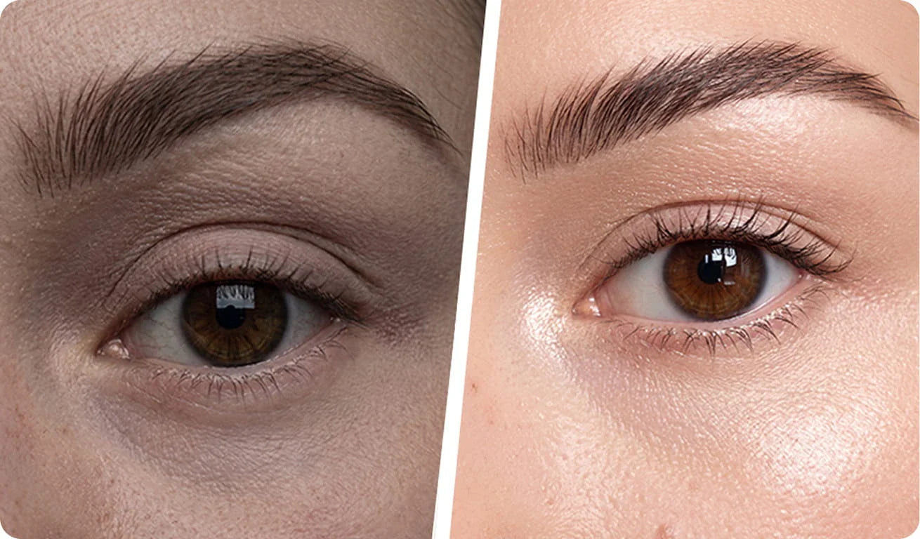 Meilleur patch yeux : comment reconnaître un patch anti-cernes efficace