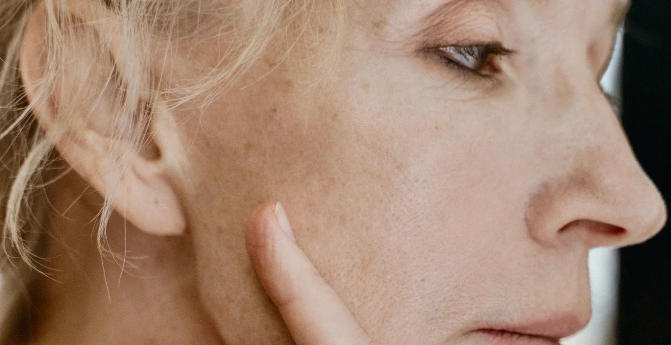 Comment enlever les taches brunes sur le visage : la méthode simple pour un teint plus uniforme Image