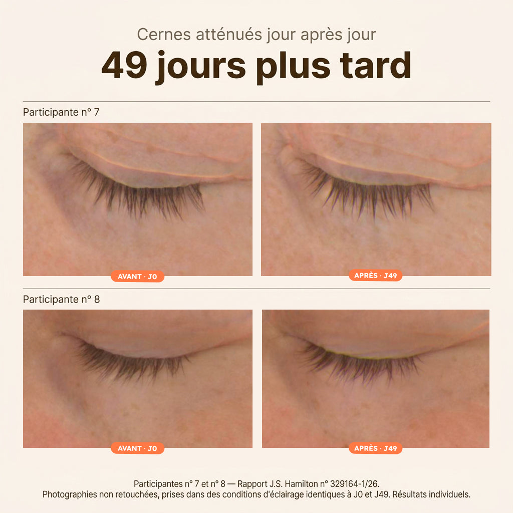 Patchs Anti-Cernes au Curcuma et à la Caféine
