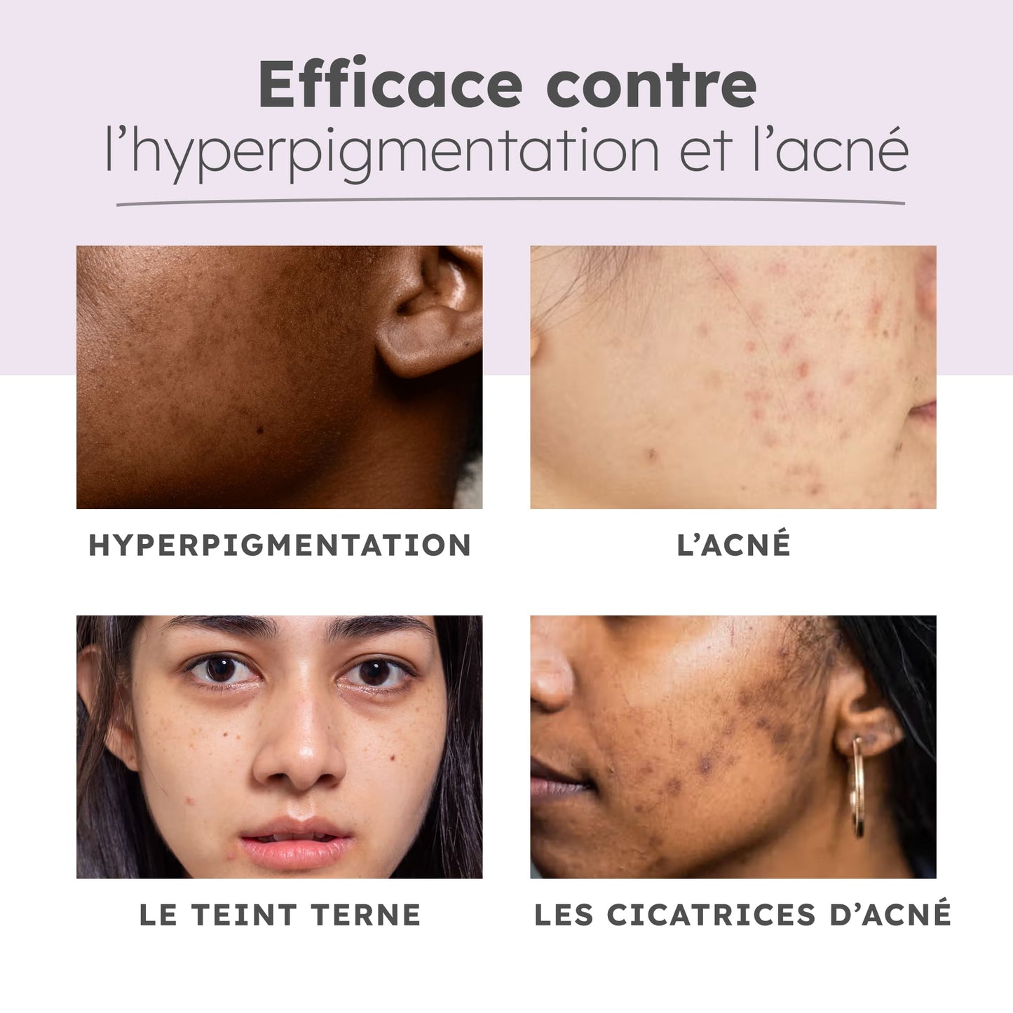 Starter Glow - Routine 3 produits