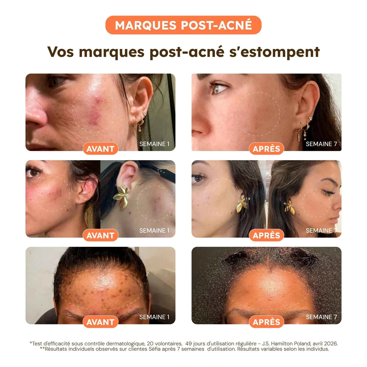Cotons Anti-Taches - Test V3-1