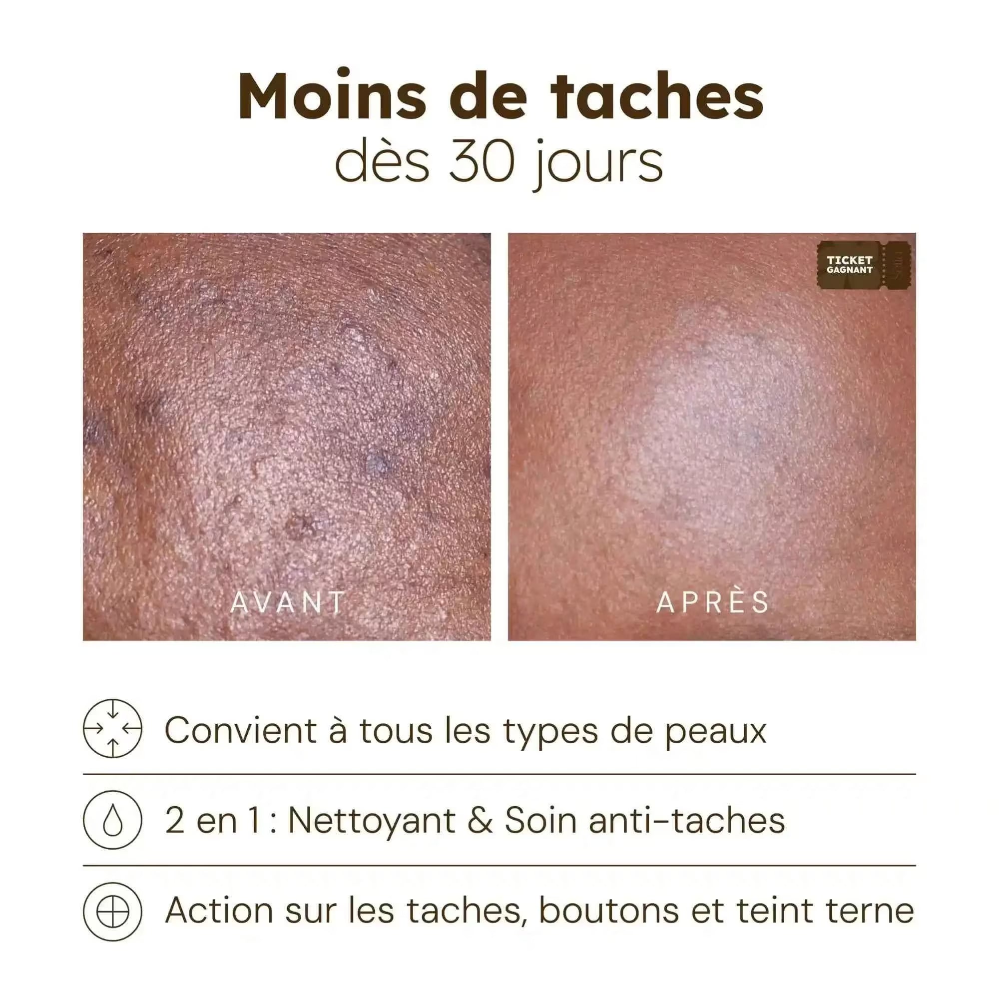 Cotons Anti-Imperfections (old)