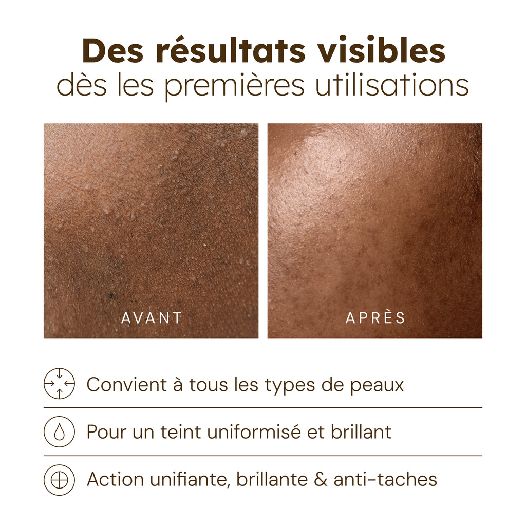 Huile visage au Curcuma