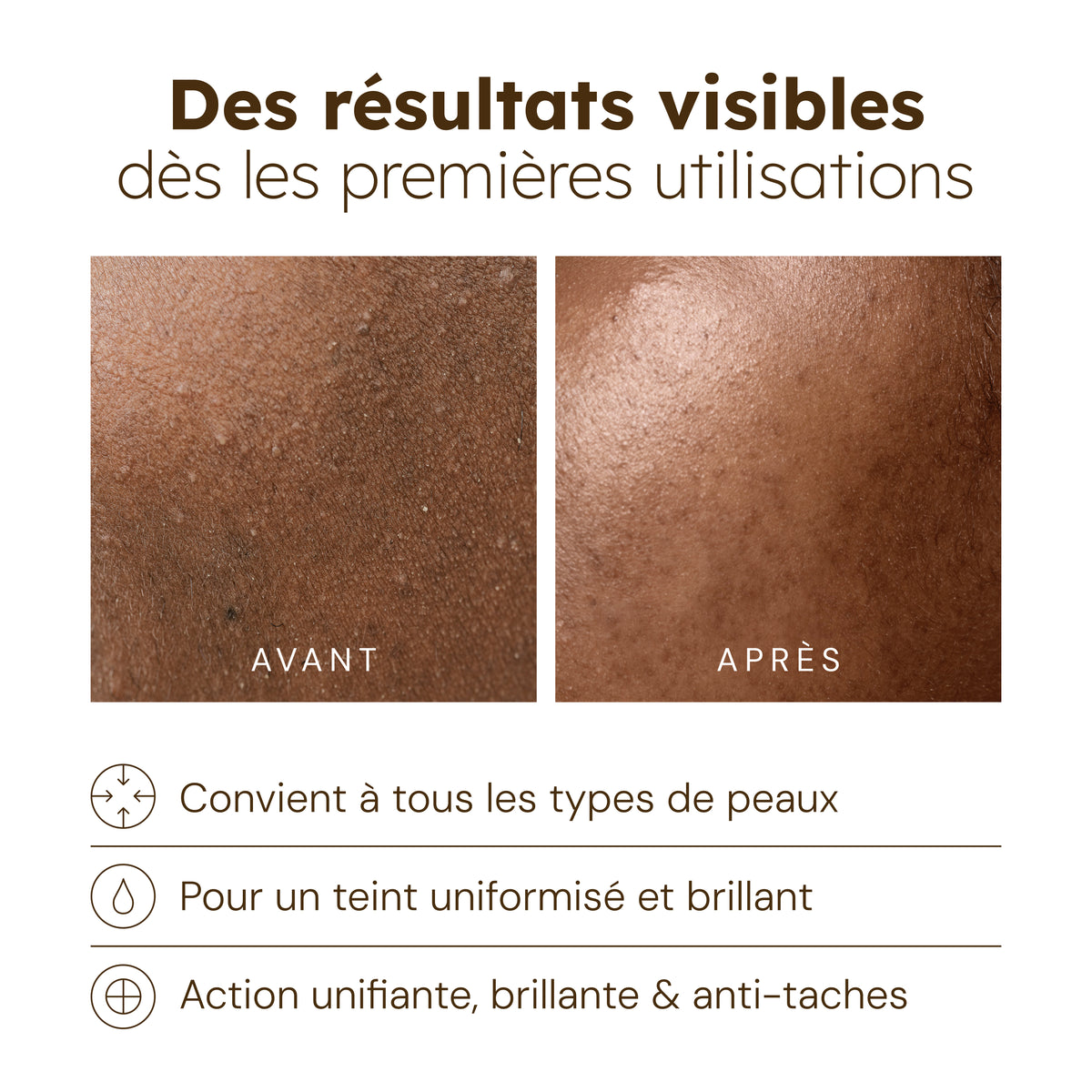 Huile visage au Curcuma