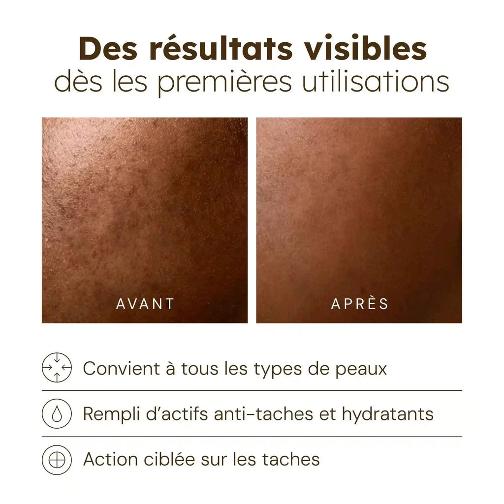 Sérum Anti-Imperfections
